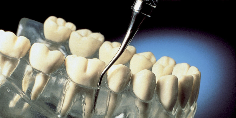 Periodontal Treatments at PERFECT SMILE